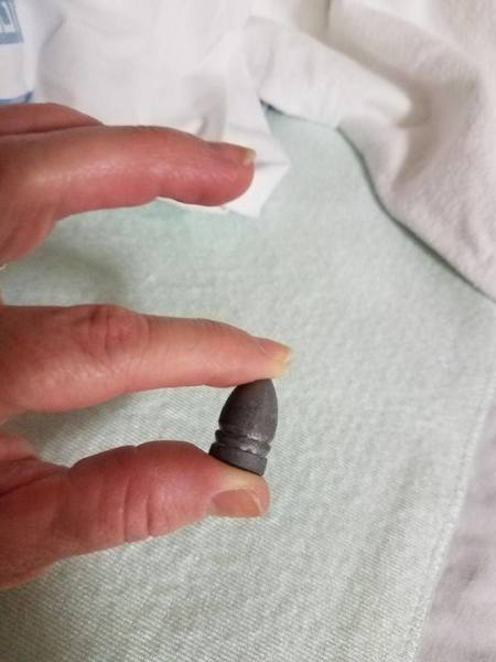The Civil War’s Latest Casualty: This Reenactor Who Shot Himself With A Minie Ball