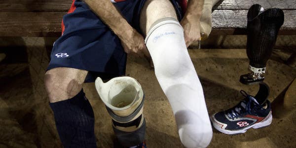 The Future Of Wounded Warrior Care Is Limb Regeneration