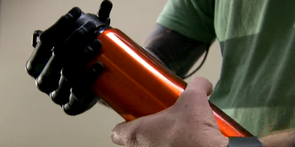 This Marine Vet Is The First Recipient Of A Revolutionary Prosthetic Hand
