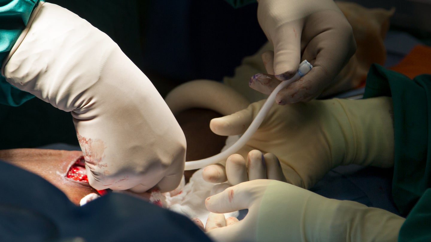 Surgeons handle a human acellular vessel during an operation. The off-the-shelf, bioengineered blood vessel is being studied for use in repairing and reconstructing various types of vascular injuries. (Humacyte Inc. via U.S. Army)