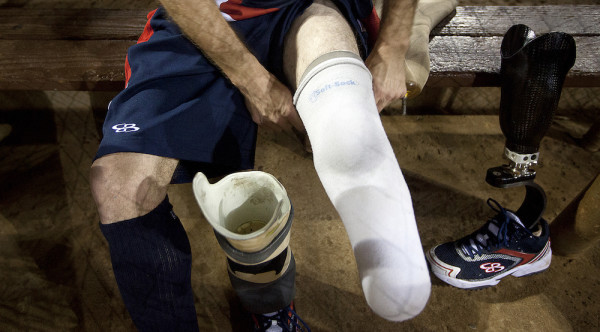 The Future Of Wounded Warrior Care Is Limb Regeneration