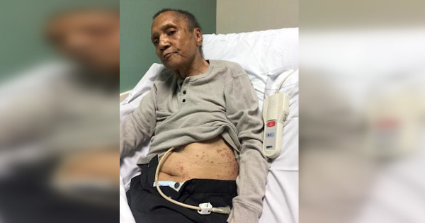 VA reassigns 9 officials after Vietnam vet found covered in ants at Atlanta VAMC