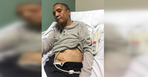 A Vietnam vet found covered in ant bites is forcing the Atlanta VA to finally reckon with years of dangerous practices