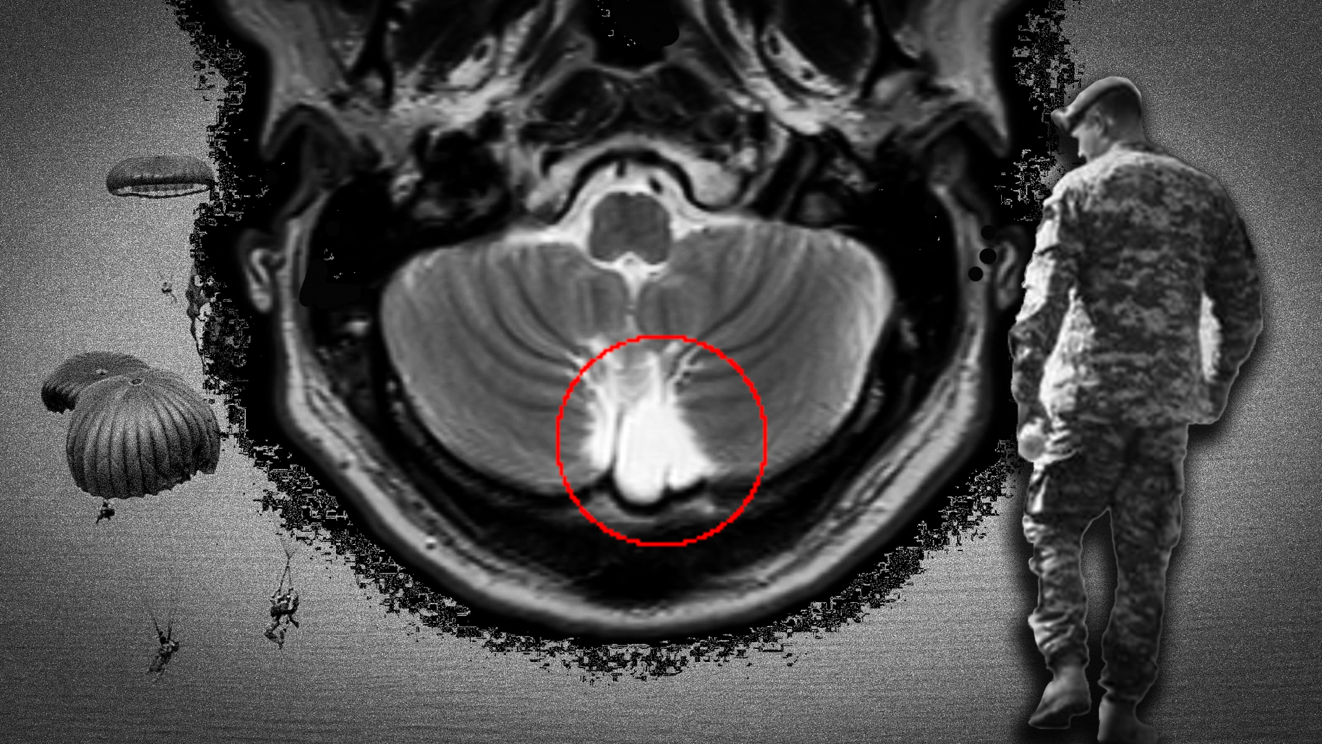 MRI scan army tbi