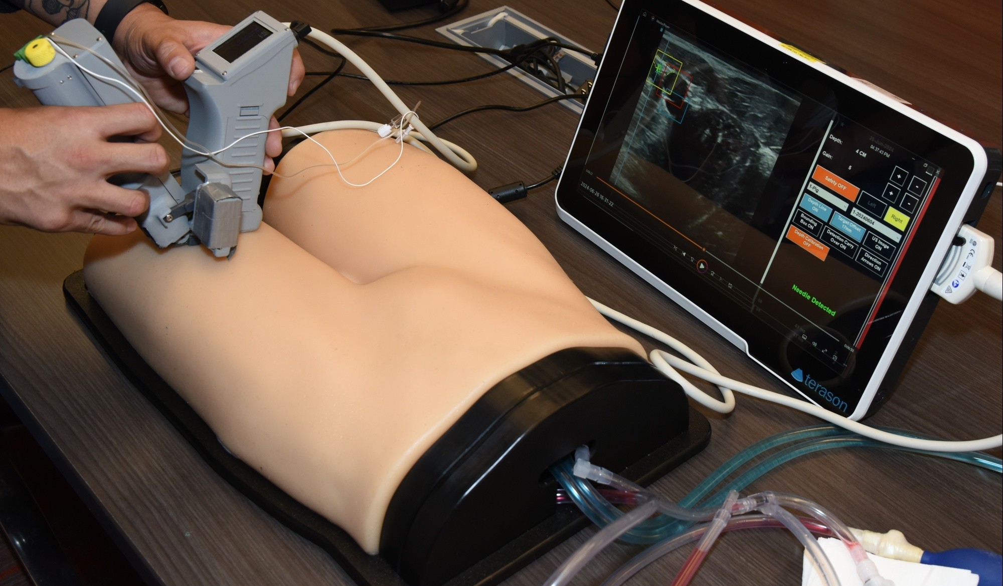 The prototype of an AI nerve block device being developed by researchers with the U.S. Army Institute of Surgical Research. Here the device is being used on a manikin during a demonstration at the VelocityTX biotechnology incubator in San Antonio, Texas, in November 2024.