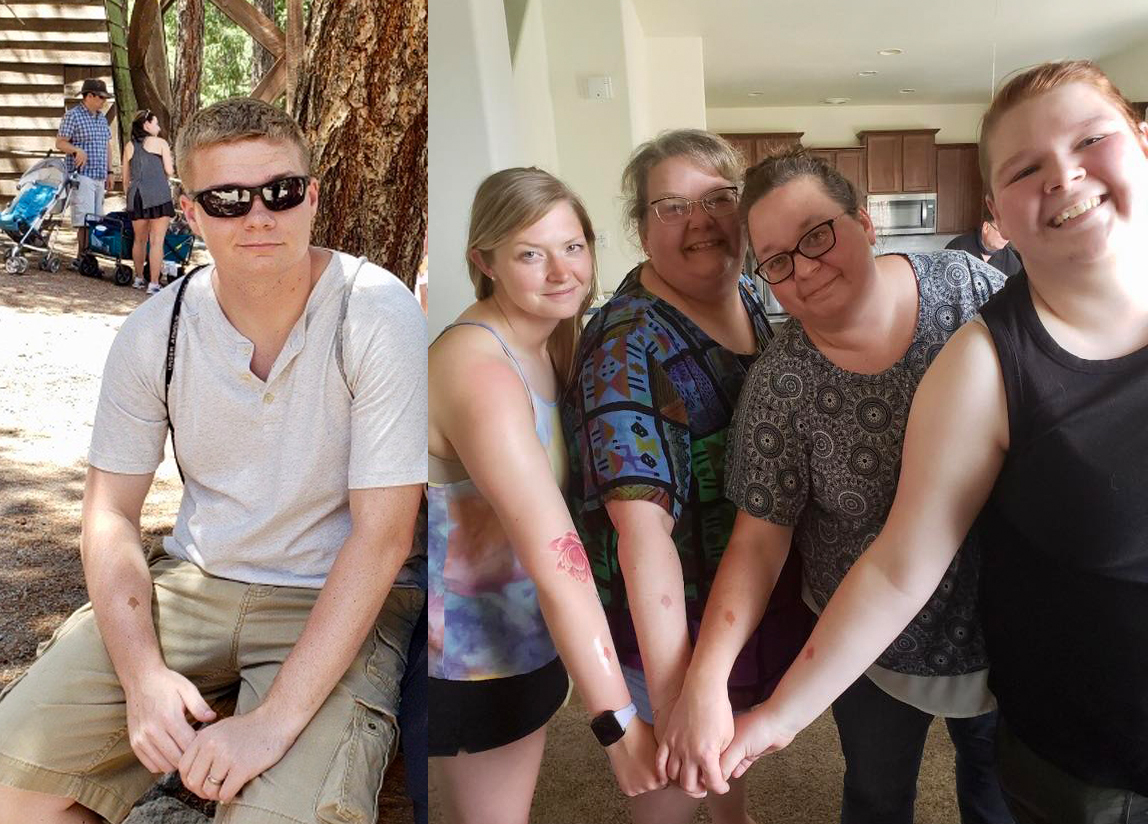 Air Force Staff Sgt. Matthew Fry's family got tattoos on their arms to match his birthmark.
